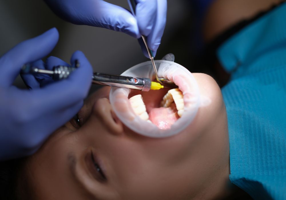 Gum Graft Surgery at 1000 Dental Smiles and Implant Center