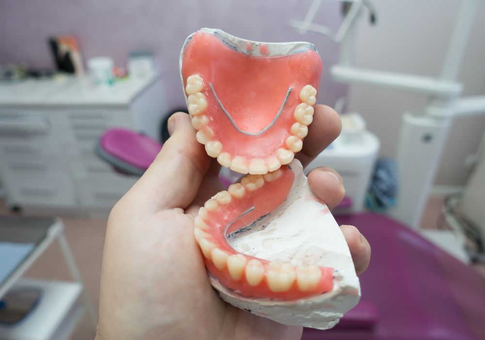 Removable Complete Denture at 1000 Dental Smiles and Implant Center