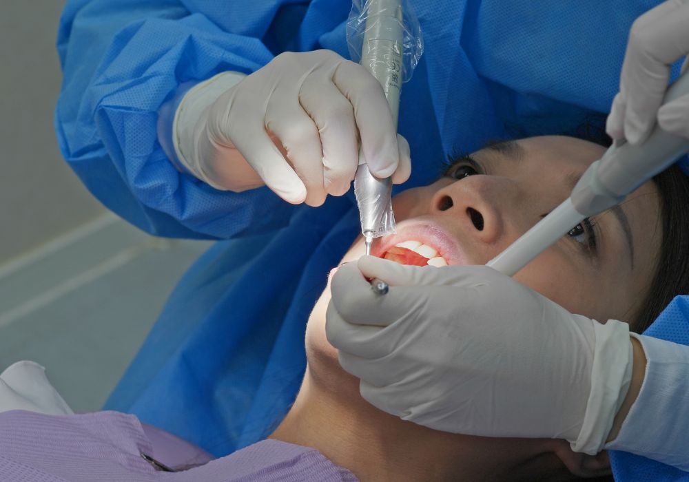 Scaling and Root Planning treatment at 1000 Dental Smiles & Implant Center